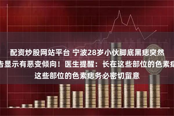 配资炒股网站平台 宁波28岁小伙脚底黑痣突然变大，病理报告显示有恶变倾向！医生提醒：长在这些部位的色素痣务必密切留意